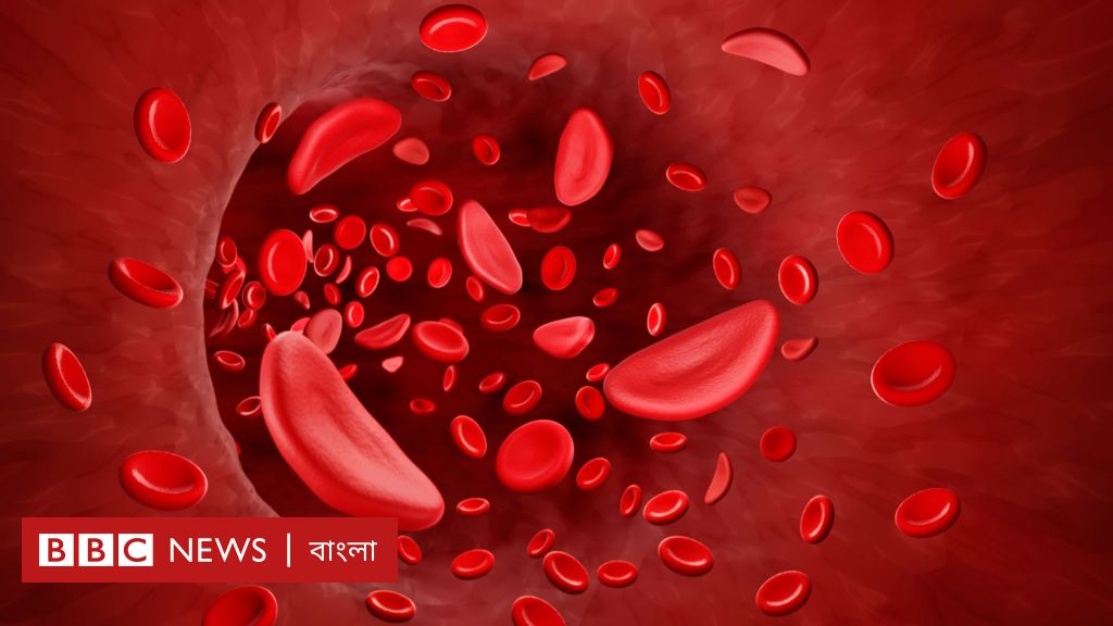 পুরুষের তুলনায় নারীরা কেন বেশি রক্তশূন্যতায় আক্রান্ত হয়? পুরুষের তুলনায় নারীরা কেন বেশি রক্তশূন্যতায় আক্রান্ত হয়?