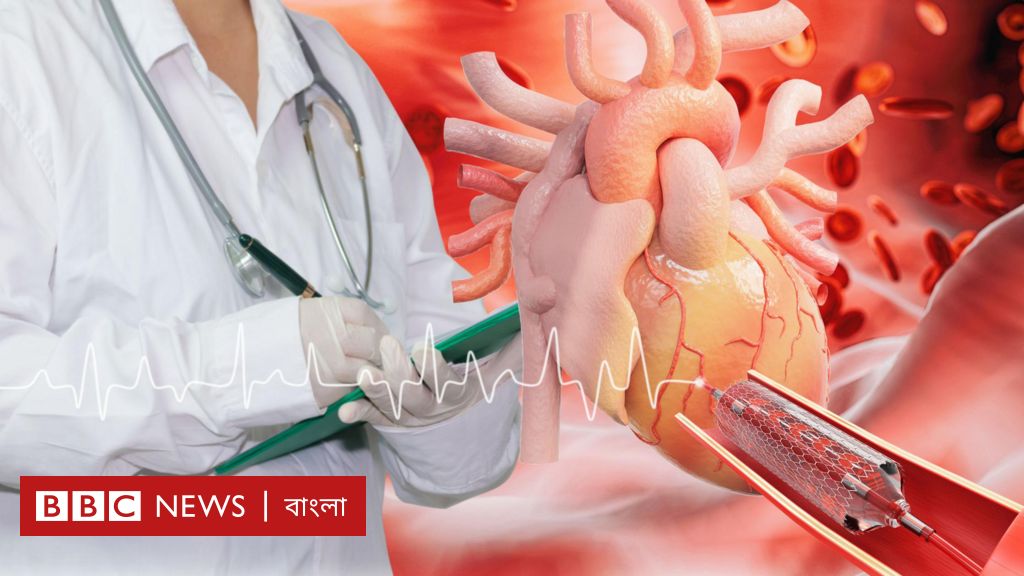 বাংলাদেশে হার্ট রিংয়ের নতুন দাম নিয়ে কী চলছে?